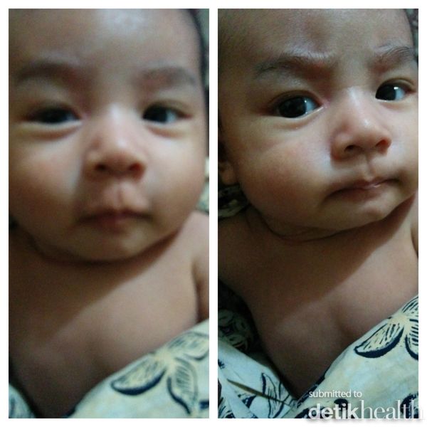 Raqilla Arfa Diandrie